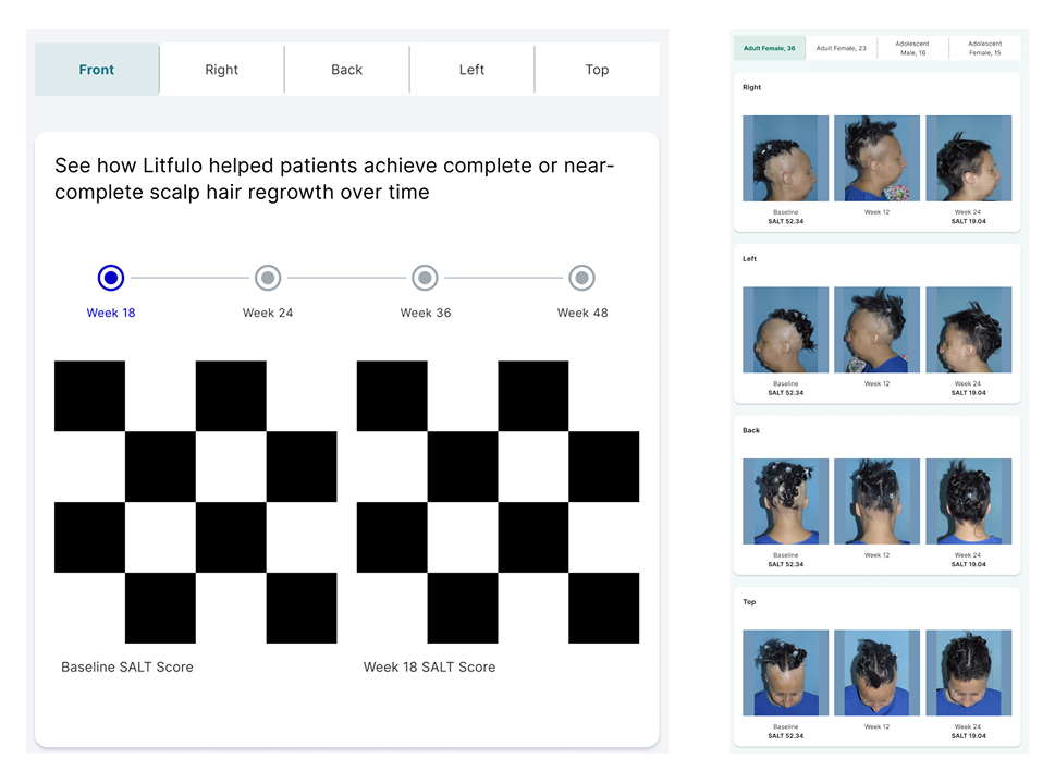 LITFULO before-and-after patient image interaction wireframe with view tabs and time controls